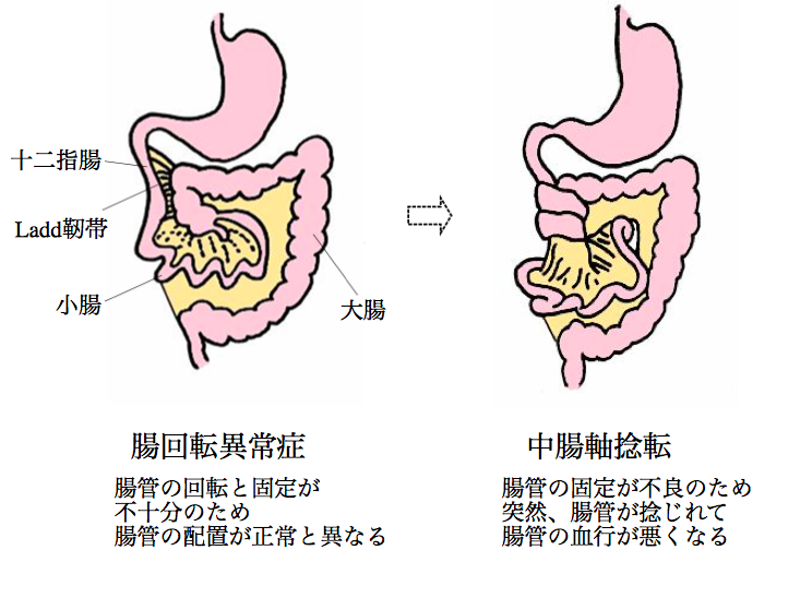 胃軸捻転 310987胃軸捻転症 赤ちゃん 症状 saikonopuremuryogazo