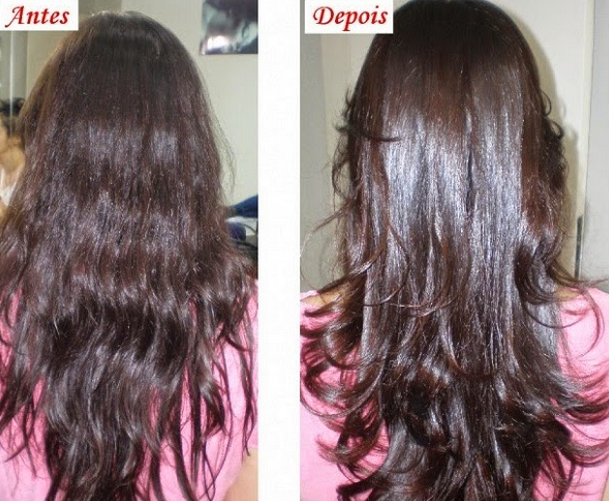 Forever Liss Cresce Cabelo Antes E Depois