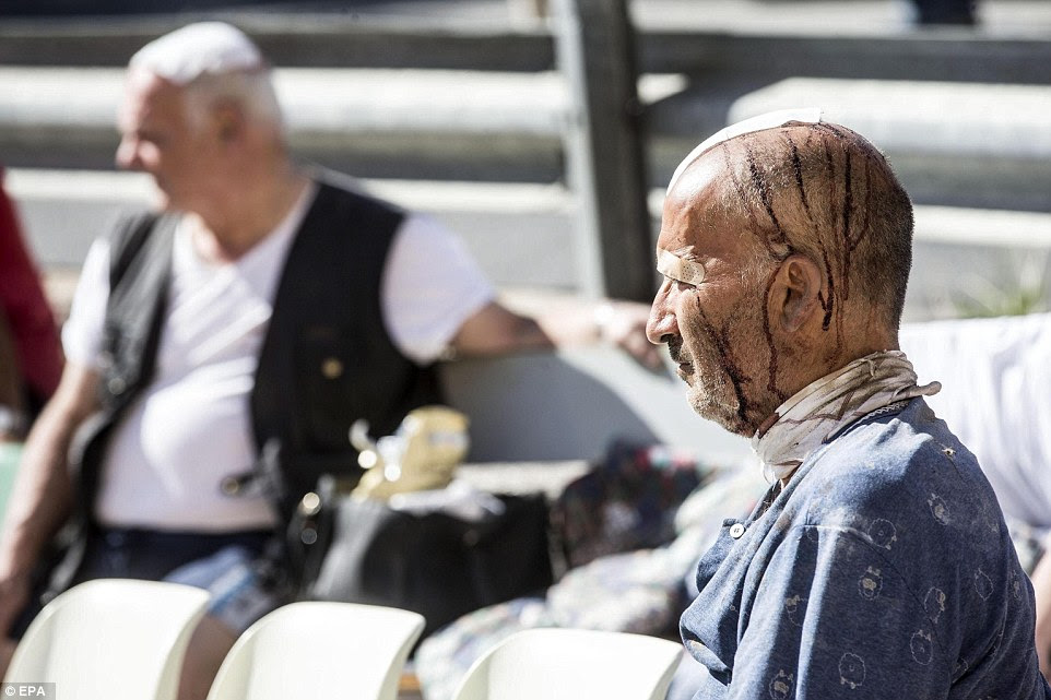 Enfaixado: Um homem que sofreu uma lesão na cabeça durante o terremoto devastador é retratado na cidade de Amatrice