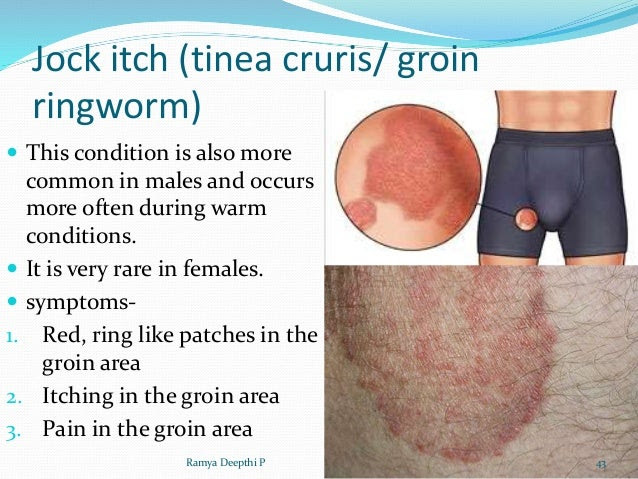 Rash In Groin Area Female Inverse Psoriasis Or Jock Itch Symptoms