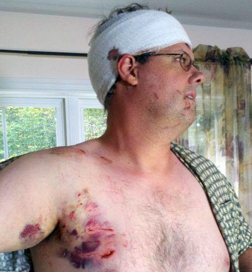The noise ran his wife Angela and saw a huge predator. She managed to distract the bear from her husband, but the animal attacked the woman. Incredible efforts they managed to get rid of a wild animal back into the forest. Angela and Richard were still alive, though they were seriously injured.