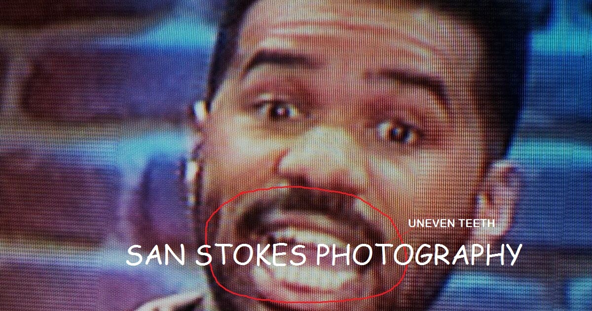 harvey steve teeth does false