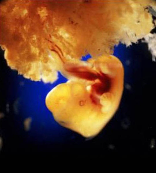 Incredible Photos: A
Child is Born Incredible Photos: A Child is Born