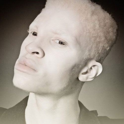 A beleza única dos albinos A beleza única dos albinos