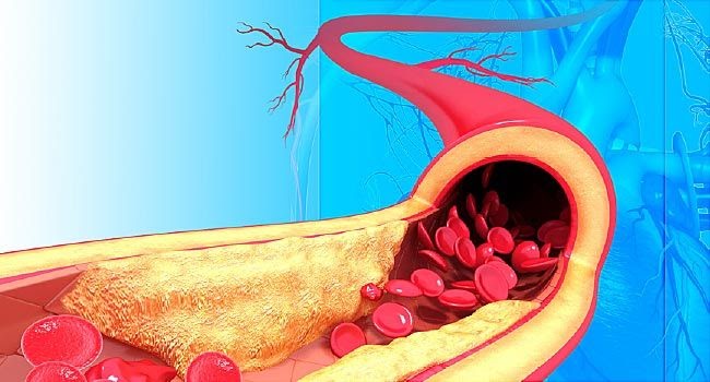 How Do Carbohydrates Affect Your Blood Pressure / Foods that raise