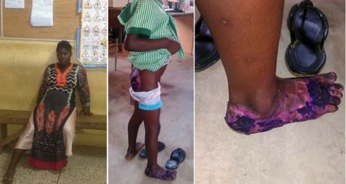 Pregnant Ghanaian Lady Dumps Her 5Yearold StepDaughter Inside Hot