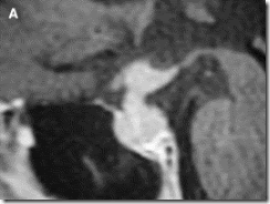 Click to enlarge figure Click to enlarge figure