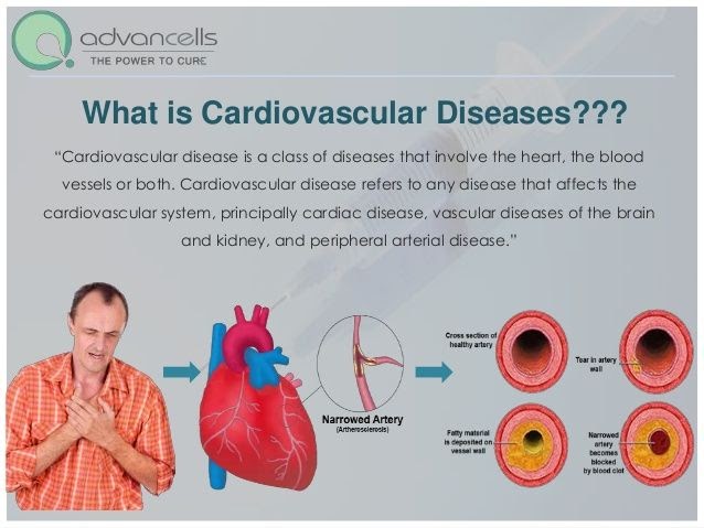 Cardiovascular cetosis