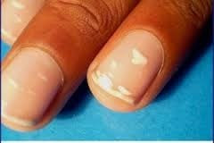ongles-points-blancs