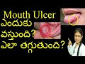 Ulcer Doctor