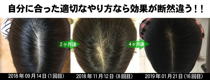 ファッショントレンド ラブリー女性 発毛 シャンプー