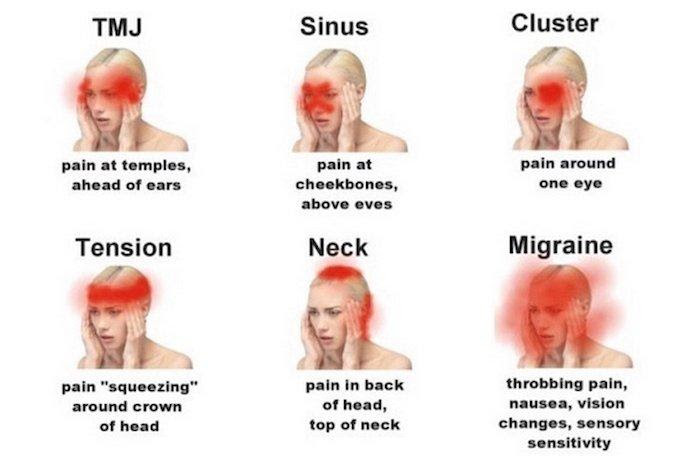 How The Painful Spot Determines the Type of Headache