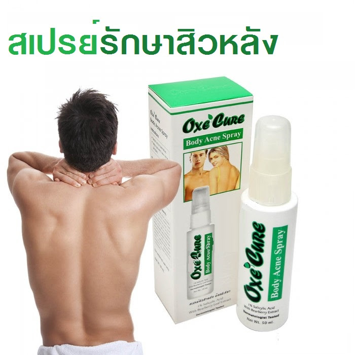 OXE CURE Body And Acne Spray ลà¸à¹à¸¥à¸°à¸à¹à¸à¸à¸à¸±à¸à¸ªà¸´à¸§à¸à¸£à¸´à¹à¸§à¸à¹à¸à¹à¸à¸«à¸¥à¸±à¸ ลำà¸à¸±à¸§ หà¸à¹à¸²à¸à¸ à¸à¸à¸²à¸à¸à¸£à¸£à¸à¸¸ 50 ml (OXECURE )