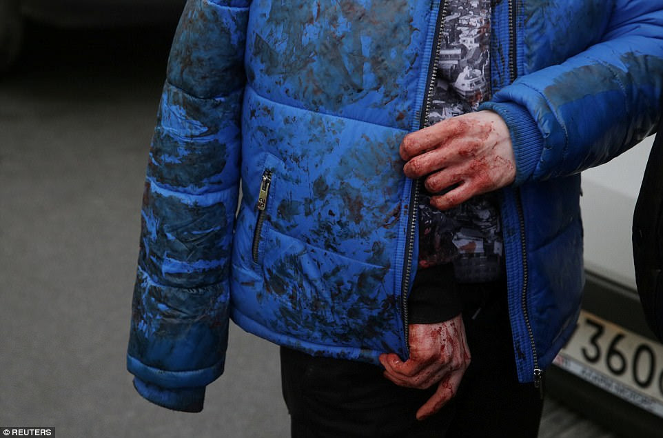 An injured person walks outside Sennaya Ploshchad metro station with a blood-drenched coat and red hands