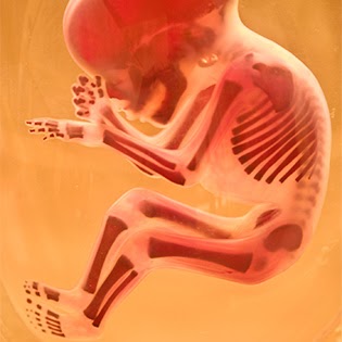 Anatomy and Physiology- It's Going Tibia Okay: Bone Growth, Development