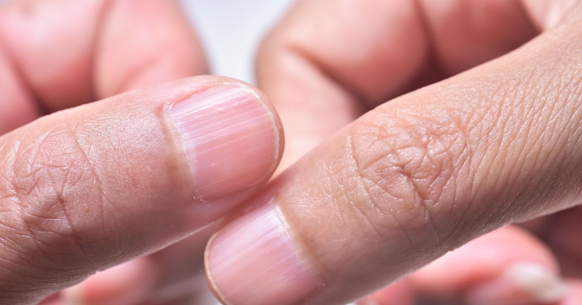 White Nail Beds Meaning