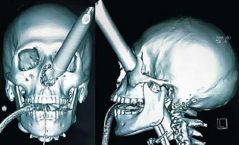 Ffximage 2007 04 19 Jtskull Wideweb 470X285,0