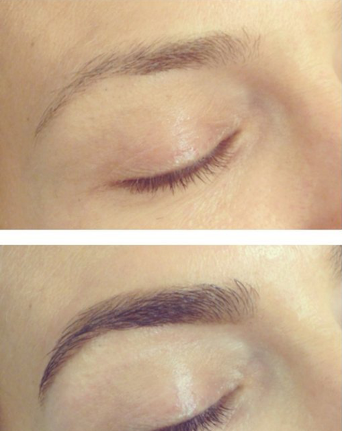 Eyebrow Before And After Castor Oil