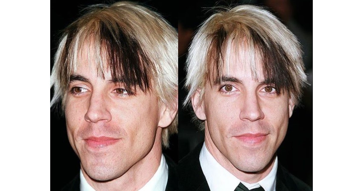Anthony's Blonde Hair: 10 Results
Anthony's Blonde Hair - wide 9