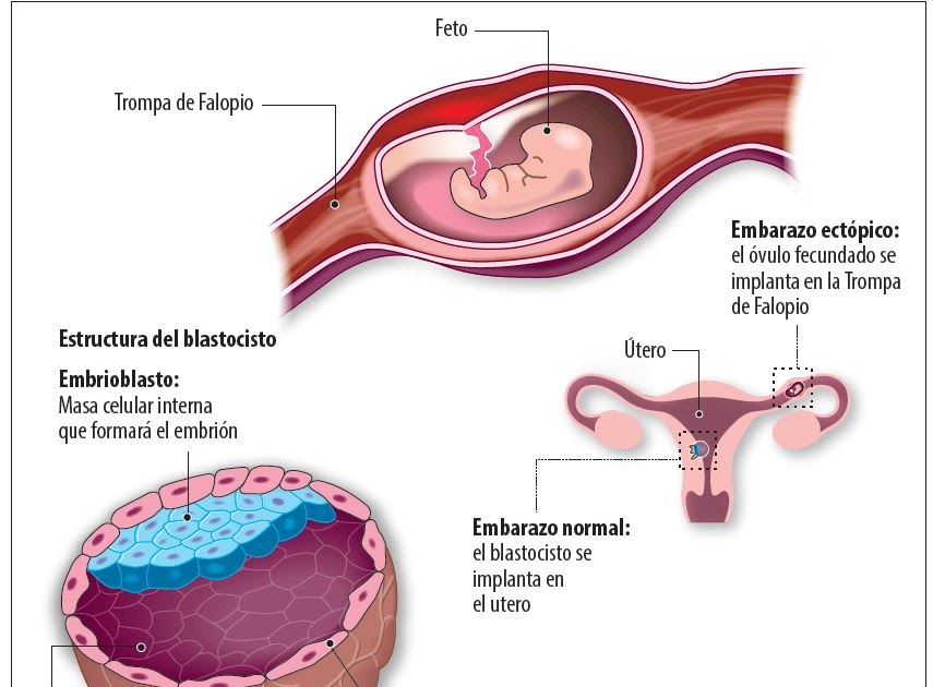 Implantación ovulo