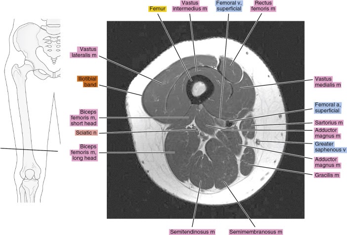 Upper Thigh Muscles Ct Anatomy / Cureus A Rare Anatomical Variant Of