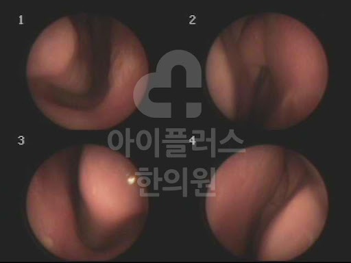 인천 축농증 한의원 혹시 나도?