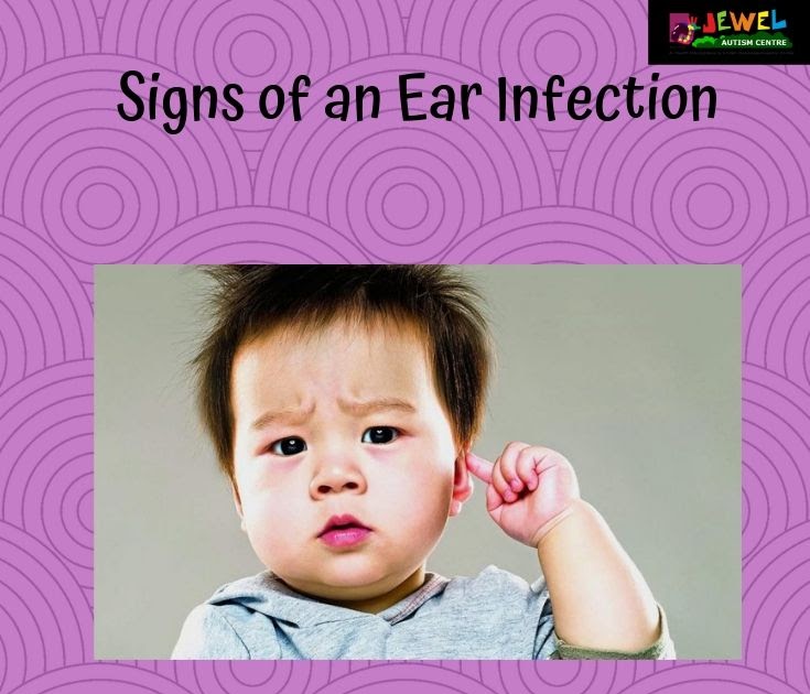Signs Of Autism In 10 Month Old