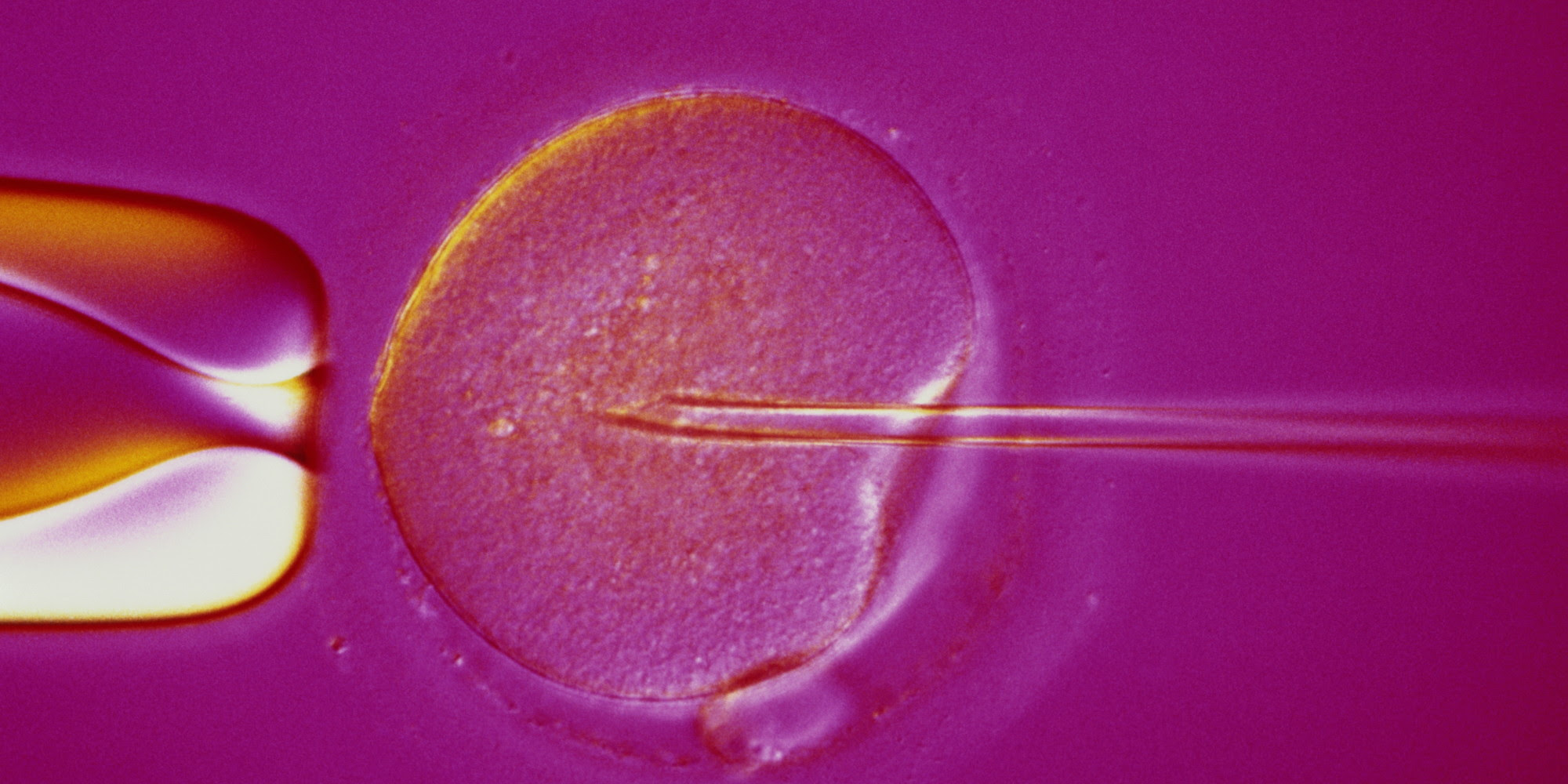 人工受精和试管婴儿有区别吗（人工授精和试管婴儿）-幼儿百科-魔术铺