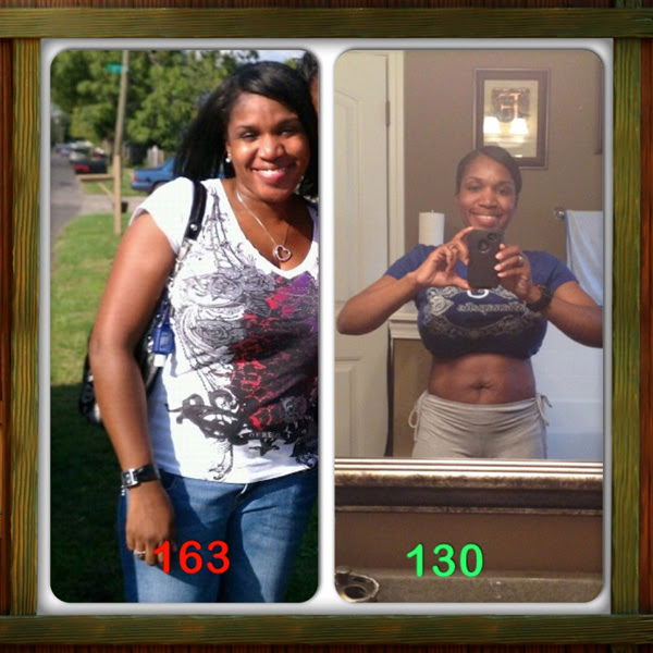 Weight Gain Mirena Removal Blog Dandk