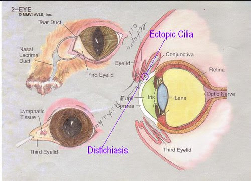myEye