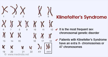 What creates depression: Klinefelter syndrome symptoms