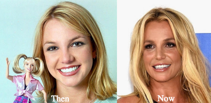 Britney Spears 2015 Plastic Surgery - Best Britney Spears ...