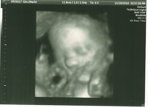 Sprog11.18.10