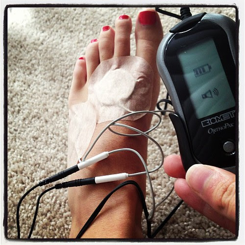 Let the bone stimulation treatments begin!