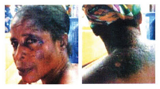 abdallah_bleaching2-thumb BLEACH AND THOSE CHEMICALS WILL DESTROY YOUR SKIN IN THE LONG RUN!