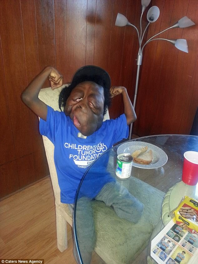 Toyeen B's World Photos Heartbreaking story of Amare Stover, an 8 y.o