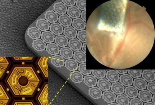 Retina solar Retina solar