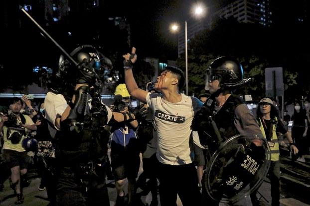 2019年7月30日，抗议者在香港葵涌警署外与防暴警察发生冲突。一名流血示威者被警察带走。（美联社）
