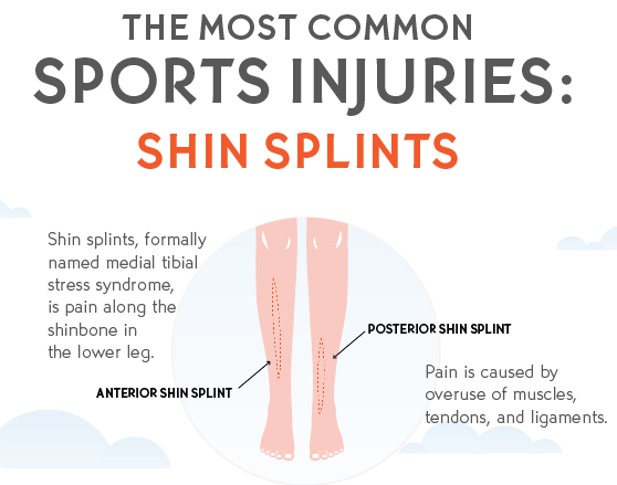 Shin Splint Symptom Diagram