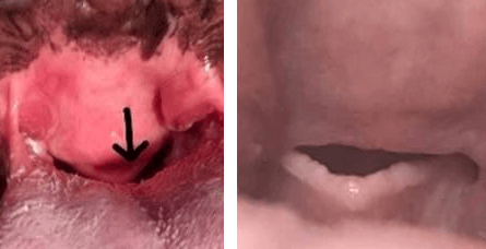 Close up of a person's mouth and mouth with an arrow
Description automatically generated