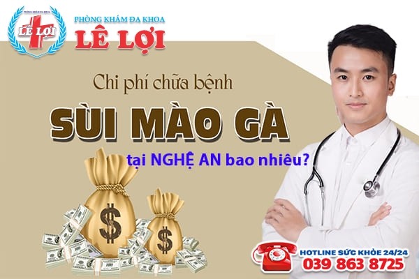 Chi phí chữa bệnh sùi mào gà ở Vinh hiện nay bao nhiêu