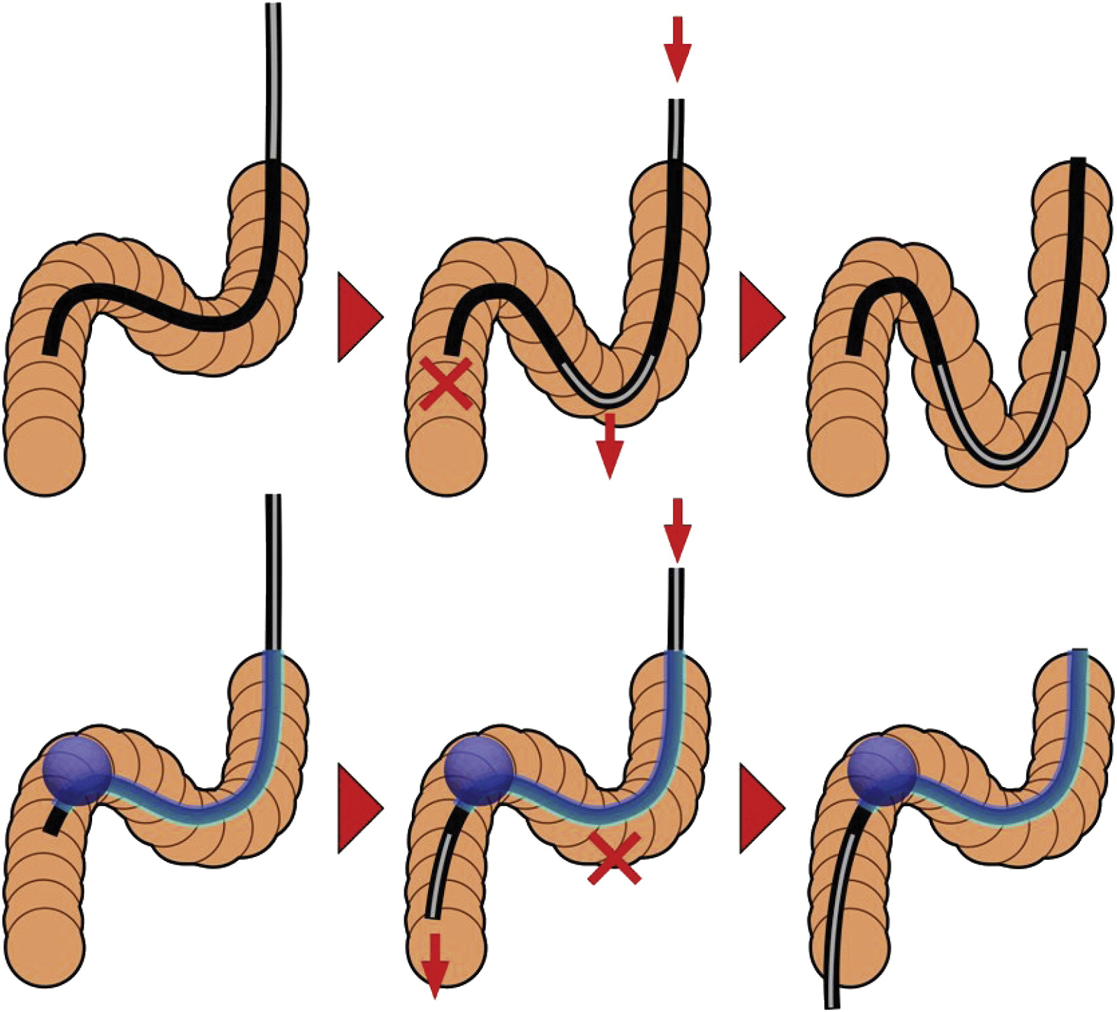 Balloon Endoscopy