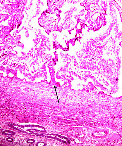 Immature cotyledon with origin of maternal septum