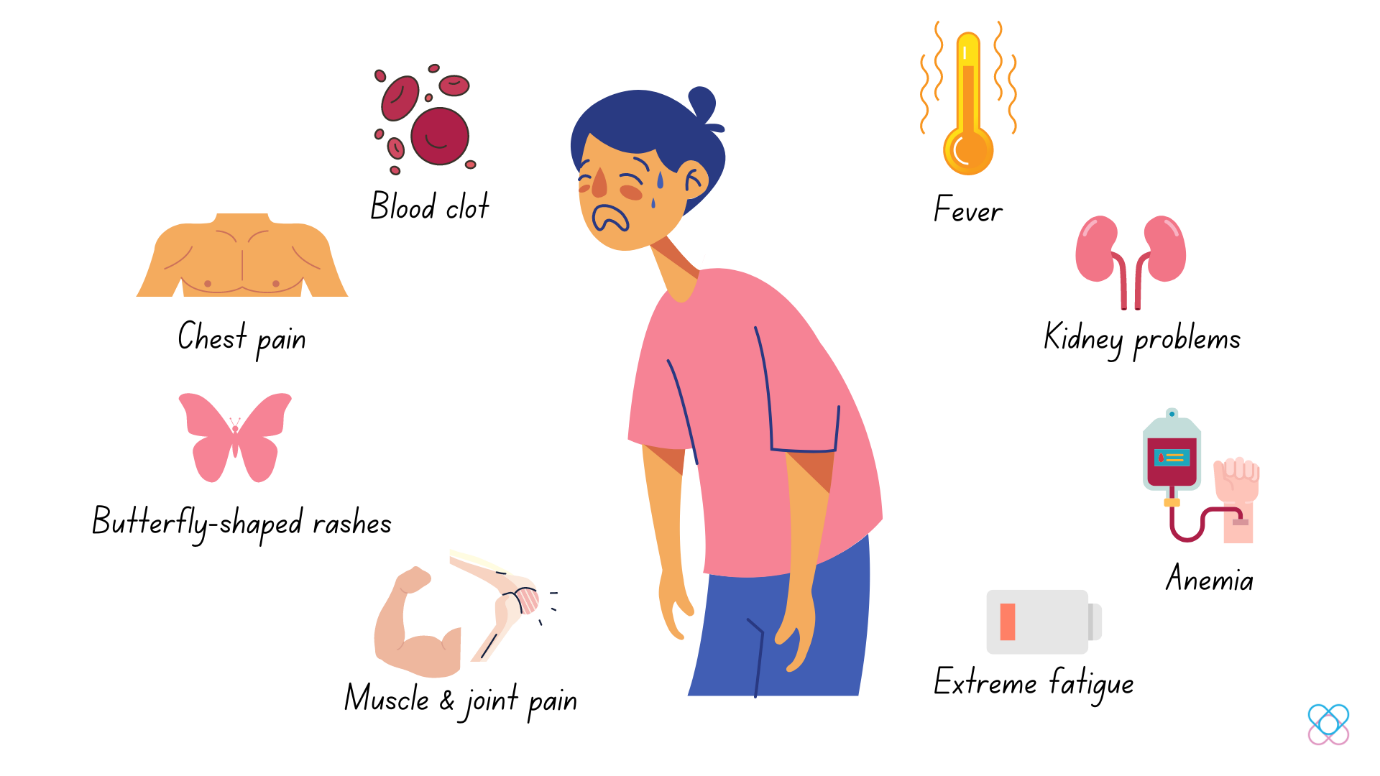 Common Lupus Symptoms