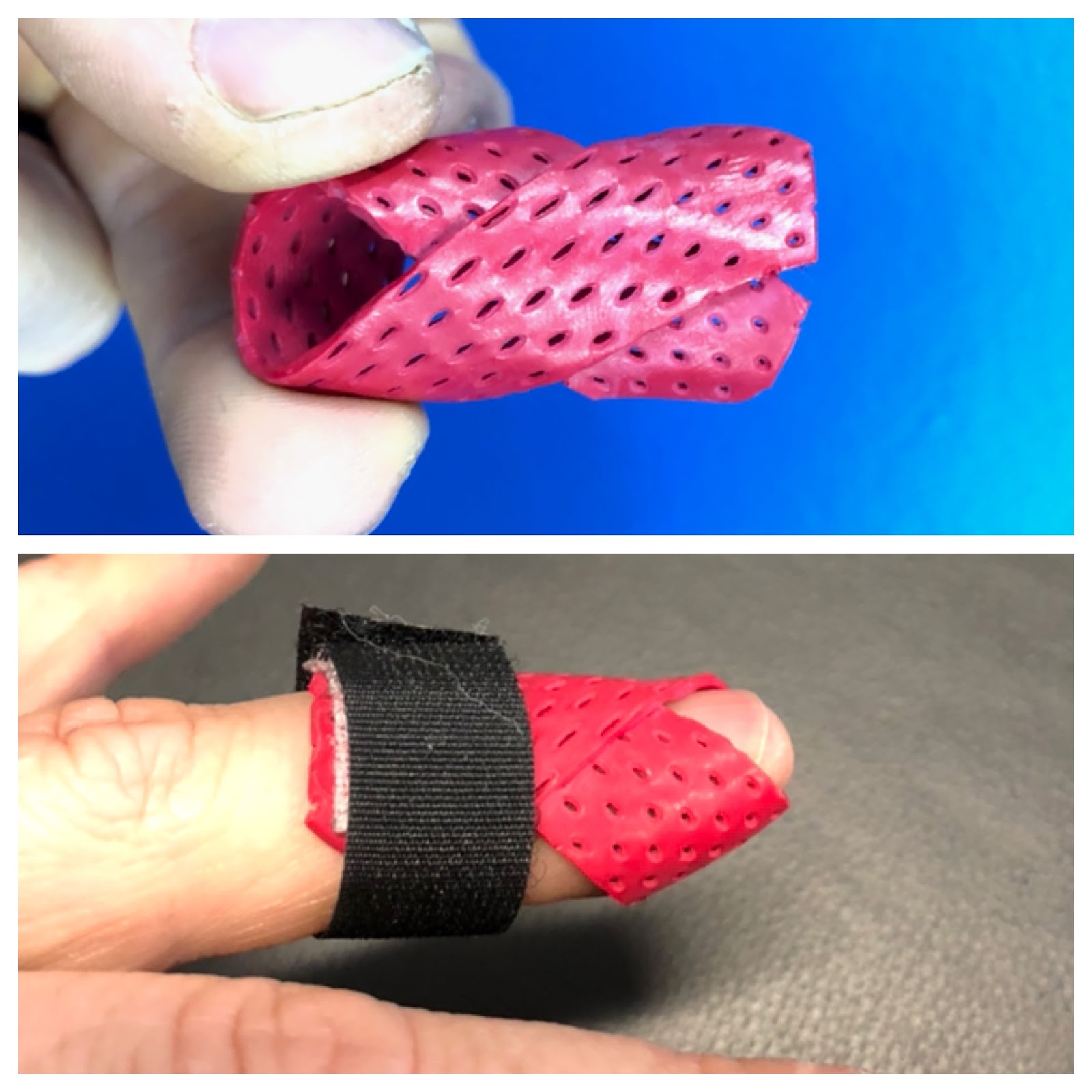 mallet finger splint pattern