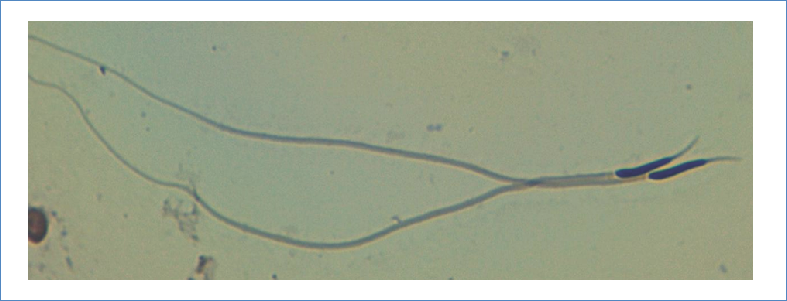 Crotalus spp. spermatozoon; the head shows the blue dyed nucleus and the translucent acrosome, the flagellum with an extremely long half piece, and an apparently naked final tail 40X.
