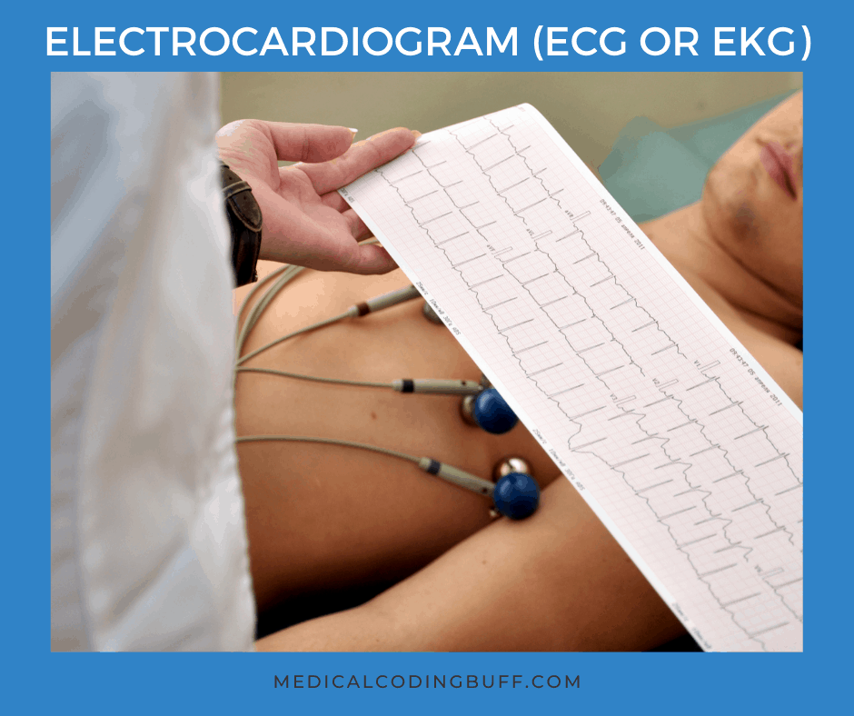 Electrocardiogram to help diagnose myocardial infarction and how to code for acute myocardial infarction in ICD-10-CM
