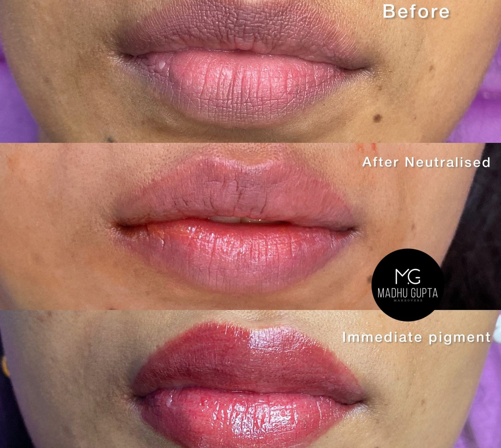 Lip Coloring and Color Correction at MG Makeover's Studio in Gurgaon