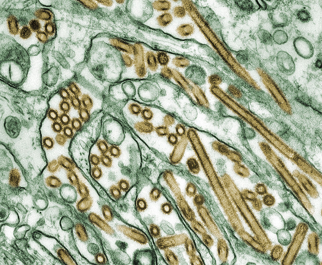 1024px-Colorized_transmission_electron_micrograph_of_Avian_influenza_A_H5N1_viruses.jpg