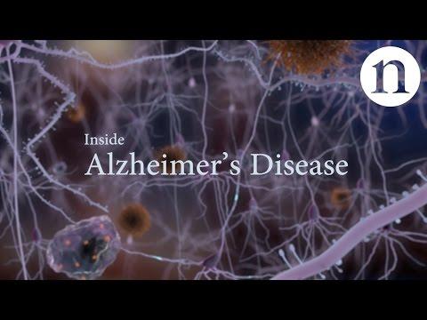 Inside Alzheimer’s disease